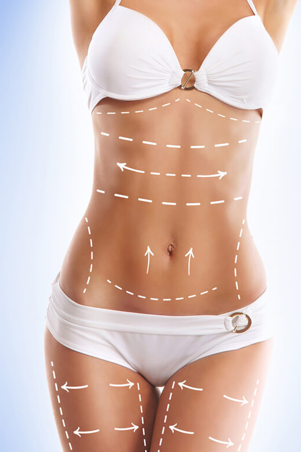 Radiofrequency
