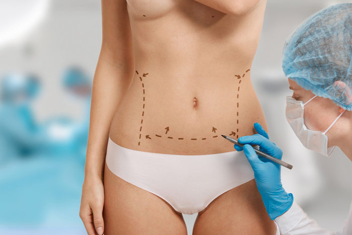 Body Aesthetics and Surgery